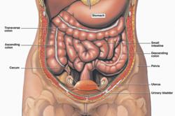 Transvaginal Mesh Implant Lawsuits